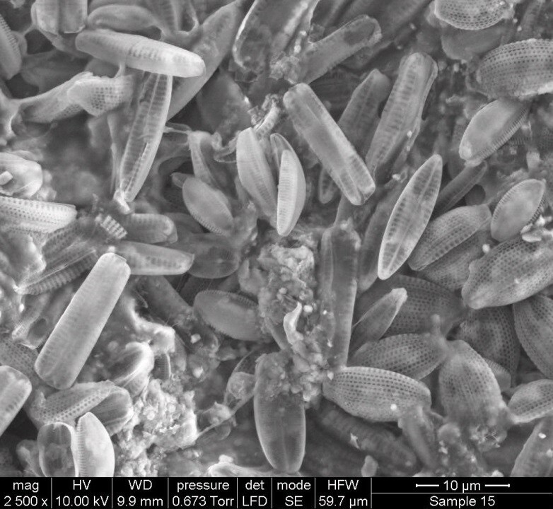 figure2-electronmicroscopy_0.jpg
